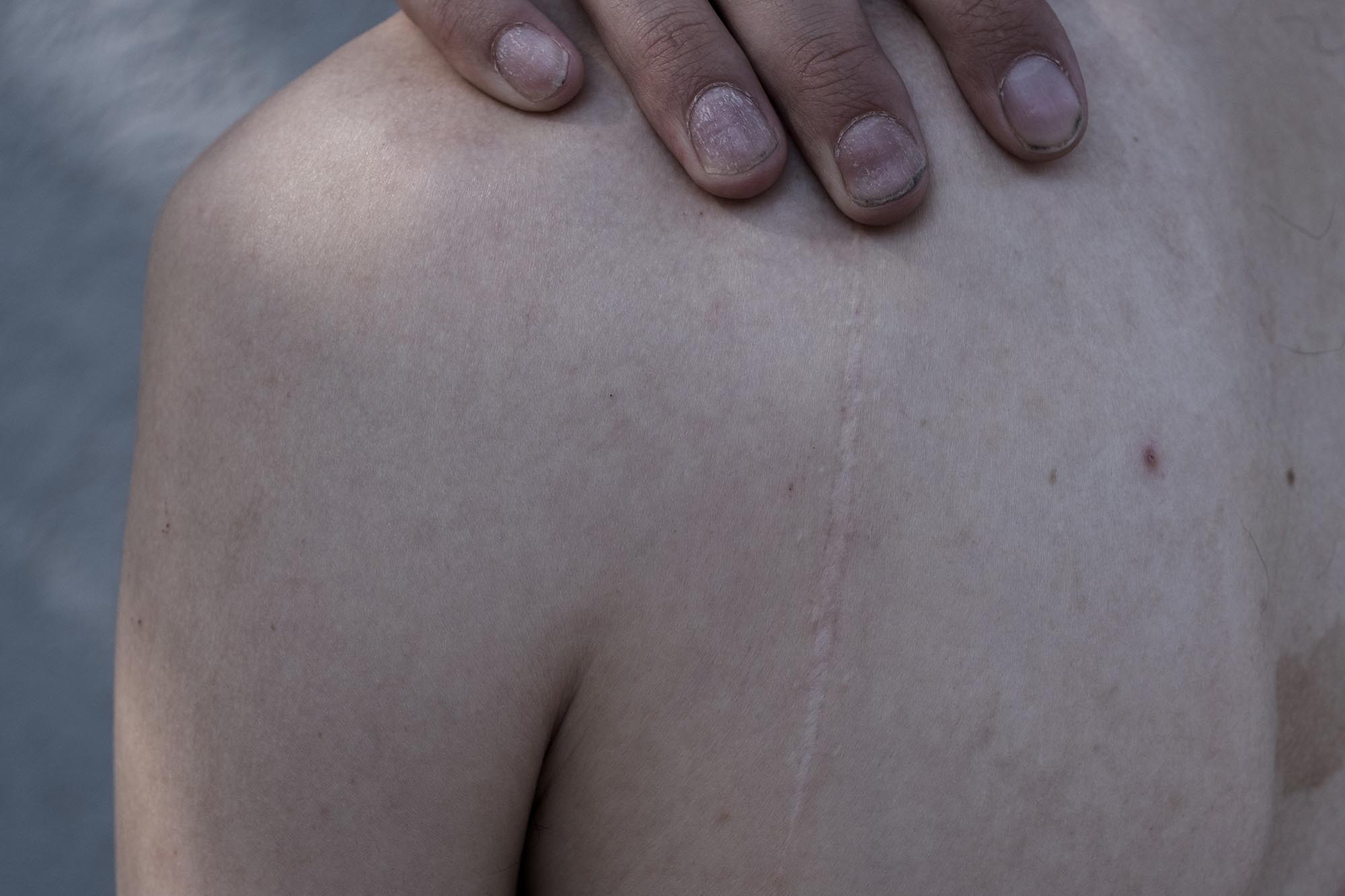 004_scar-tissue_Innovate-Grant-Evgenii-Petrushanskii