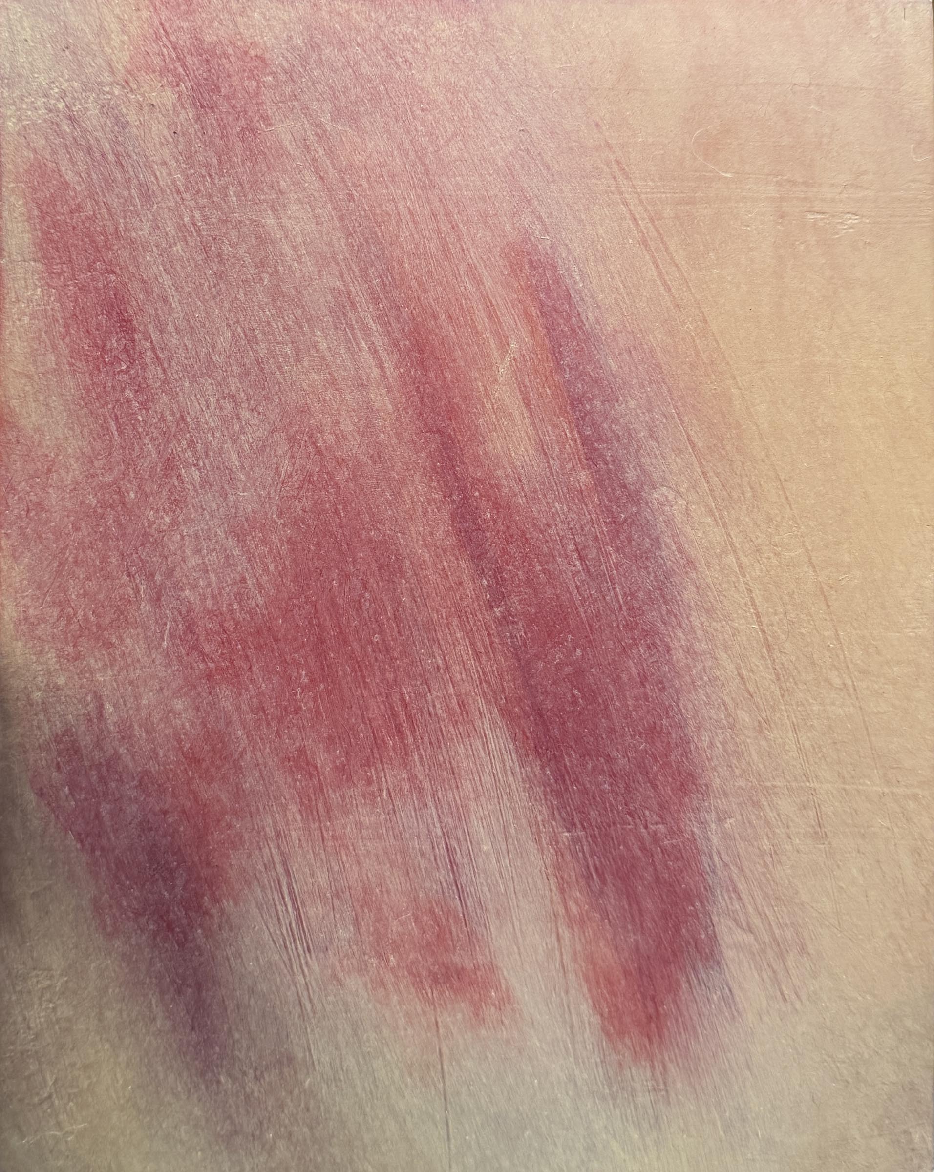 Koda-Smith_Bruise-12_2026